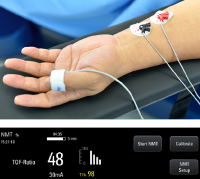 Аппарат наркозно-дыхательный высокого класса A7 - 0 руб.