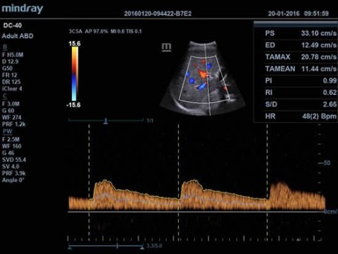 Аппарат ультразвуковой диагностический DC-40 - 392 100 руб.