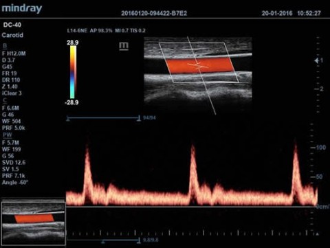 Аппарат ультразвуковой диагностический DC-40 - 392 100 руб.