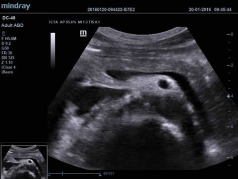 Аппарат ультразвуковой диагностический DC-40 - 392 100 руб.