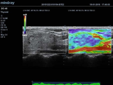 Аппарат ультразвуковой диагностический DC-40 - 392 100 руб.