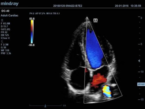 Аппарат ультразвуковой диагностический DC-40 - 392 100 руб.