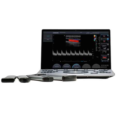 УЗИ аппарат Chison SonoAir 60 - 600 600 руб.