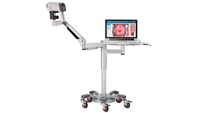 Видеокольпоскоп Edan C6A - 0 руб.