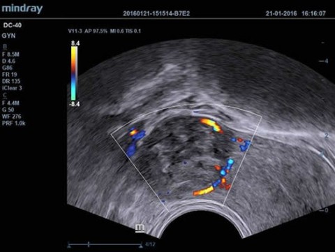 Аппарат ультразвуковой диагностический DC-40 - 384 400 руб.