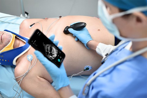 УЗИ сканер Mindray TE Air i3P - 333 000 руб.