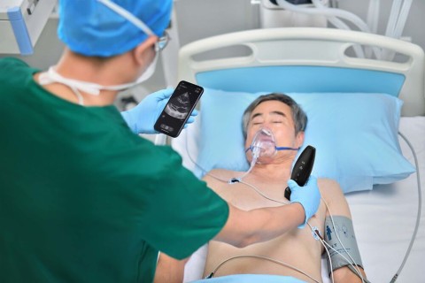 УЗИ сканер Mindray TE Air i3P - 333 000 руб.