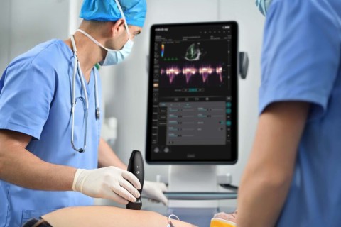 УЗИ сканер Mindray TE Air i3P - 333 000 руб.