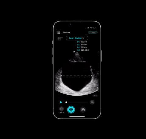 УЗИ сканер Mindray TE Air i3P - 333 000 руб.