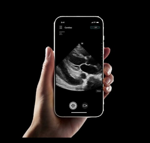 УЗИ сканер Mindray TE Air i3P - 333 000 руб.