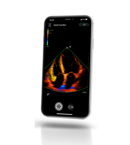 УЗИ сканер Mindray TE Air i3P - 333 000 руб.