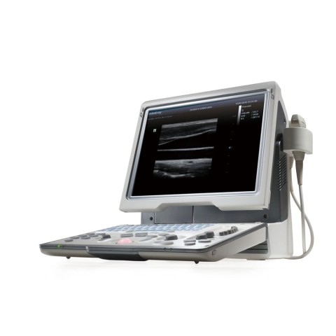 УЗИ аппарат Mindray DP-50 Color - 344 300 руб.